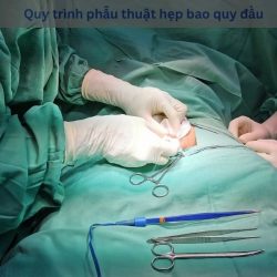 https://chuabenhlaubacninh.com/wp-content/uploads/2024/07/Quy-trinh-phau-thuat-hep-bao-quy-dau-250x250.jpg