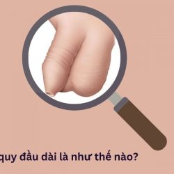 https://chuabenhlaubacninh.com/wp-content/uploads/2024/07/bao-quy-dau-dai-la-nhu-the-nao-250x250.jpg