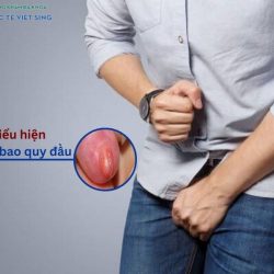 https://chuabenhlaubacninh.com/wp-content/uploads/2024/07/bieu-hien-viem-bao-quy-dau-2-250x250.jpg