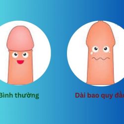 https://chuabenhlaubacninh.com/wp-content/uploads/2024/07/dai-bao-quy-dau-250x250.jpg