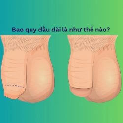 https://chuabenhlaubacninh.com/wp-content/uploads/2024/07/dai-bao-quy-dau-la-nhu-the-nao-250x250.jpg