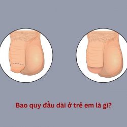 https://chuabenhlaubacninh.com/wp-content/uploads/2024/07/dai-bao-quy-dau-o-tre-250x250.jpg