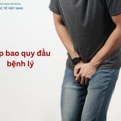 https://chuabenhlaubacninh.com/wp-content/uploads/2024/07/hep-bao-quy-dau-benh-ly-250x250.jpg