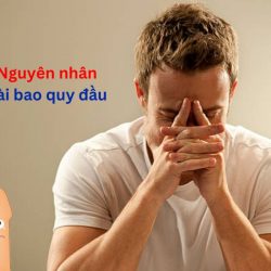 https://chuabenhlaubacninh.com/wp-content/uploads/2024/07/nguyen-nhan-dai-bao-quy-dau-250x250.jpg