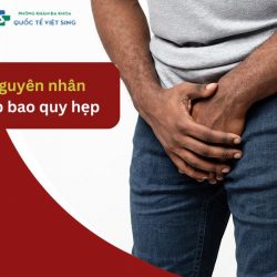 https://chuabenhlaubacninh.com/wp-content/uploads/2024/07/nguyen-nhan-hep-bao-quy-dau-2-250x250.jpg
