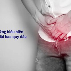 https://chuabenhlaubacninh.com/wp-content/uploads/2024/07/nhung-bieu-hien-cua-dai-bao-quy-dau-250x250.jpg