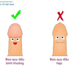 https://chuabenhlaubacninh.com/wp-content/uploads/2024/07/phan-biet-baoquy-dau-hep-250x250.jpg