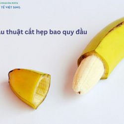 https://chuabenhlaubacninh.com/wp-content/uploads/2024/07/phau-thuat-cat-hep-bao-quy-dau-2-250x250.jpg