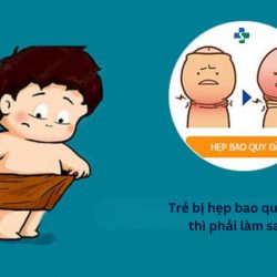 https://chuabenhlaubacninh.com/wp-content/uploads/2024/07/tre-bi-hep-bao-quy-dau-phai-lam-sao-250x250.jpg