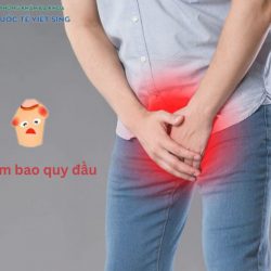 https://chuabenhlaubacninh.com/wp-content/uploads/2024/07/viem-bao-quy-dau-250x250.jpg