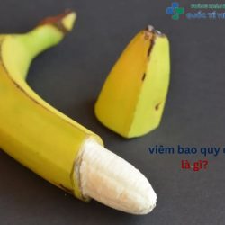 https://chuabenhlaubacninh.com/wp-content/uploads/2024/07/viem-bao-quy-dau-la-gi-250x250.jpg