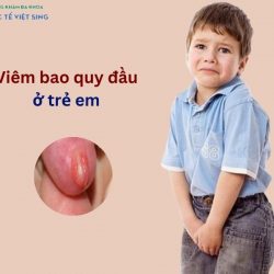 https://chuabenhlaubacninh.com/wp-content/uploads/2024/07/viem-bao-quy-dau-o-tre-250x250.jpg