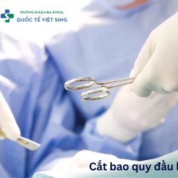 https://chuabenhlaubacninh.com/wp-content/uploads/2024/08/cat-bao-quy-dau-la-gi-250x250.jpg