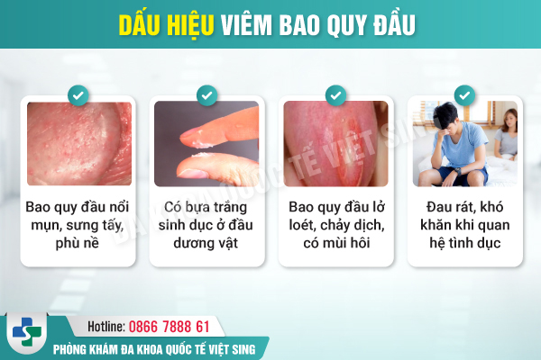 https://chuabenhlaubacninh.com/wp-content/uploads/2025/03/80.jpg