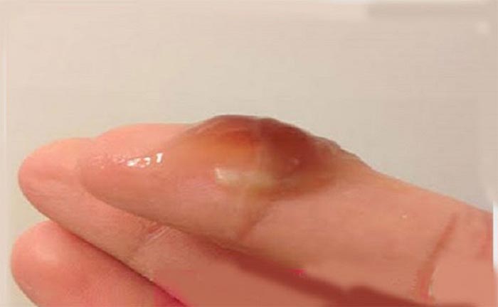 Khí hư có máu: Đừng chủ quan trước dấu hiệu bất thường